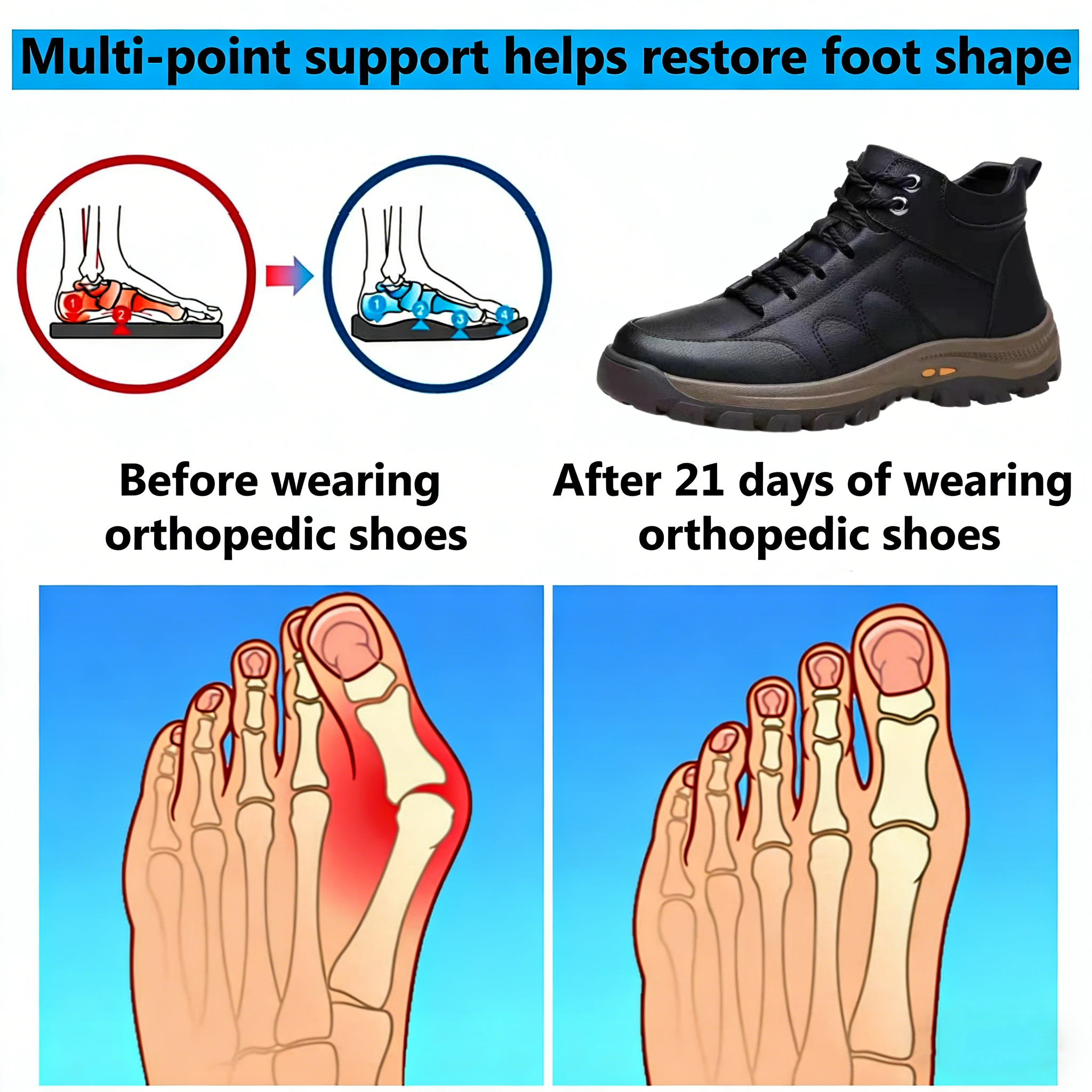 【⏰Limited time offer: 70% off – Don't miss it!】Ergonomic orthopedic shoes – ✅️Corrects posture while walking and relieves foot pain – Newly improved waterproof and anti-slip 👞Selected Australian leather