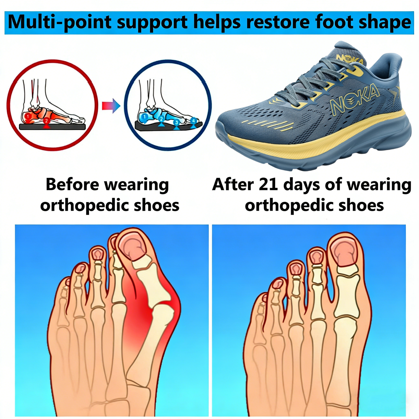 【⏰Limited-Time 50% Off - Don't Miss Out】Brand New Ergonomic Orthotic Shoes - ✅️Corrects Posture While Walking - Upgraded Waterproof and Slip-Resistant 👞