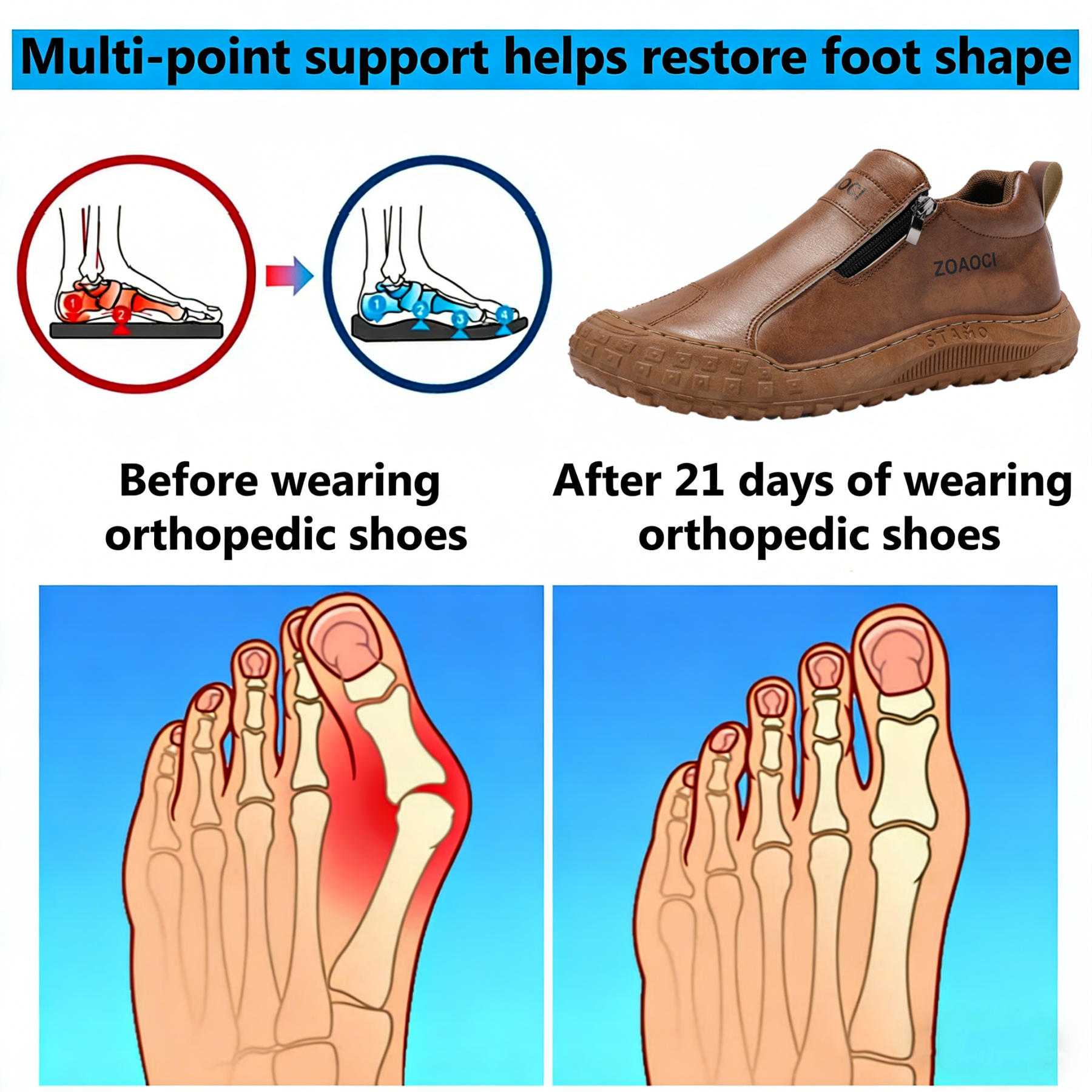 【⏰Limited Time 50% Off - Don't Miss It】Ergonomic Orthopedic Shoes - ✅️ Posture Correction While Walking - Waterproof and Anti-Slip 👞 Selected Australian Leather