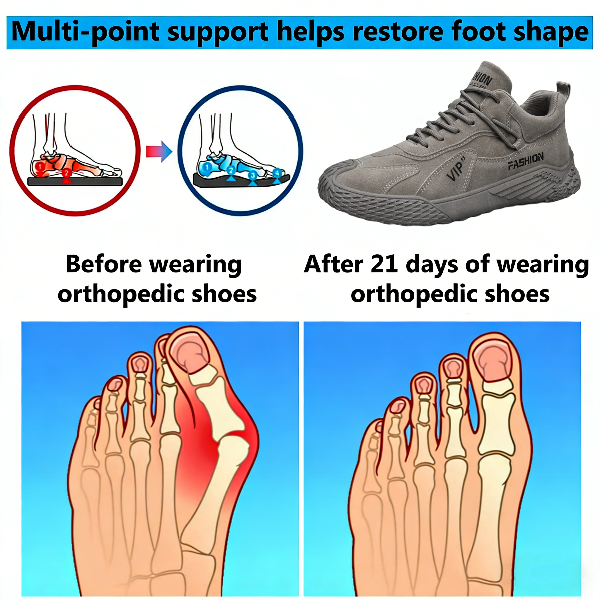 【⏰Limited Time 50% Off - Don't Miss It】Ergonomic Orthopedic Shoes - ✅️ Posture Correction While Walking - Waterproof and Anti-Slip 👞 Selected Australian Leather