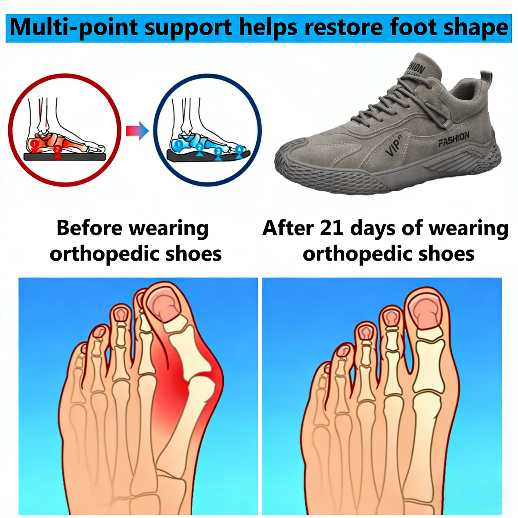 【⏰Limited Time 50% Off - Don't Miss It】Ergonomic Orthopedic Shoes - ✅️ Posture Correction While Walking - Waterproof and Anti-Slip 👞 Selected Australian Leather