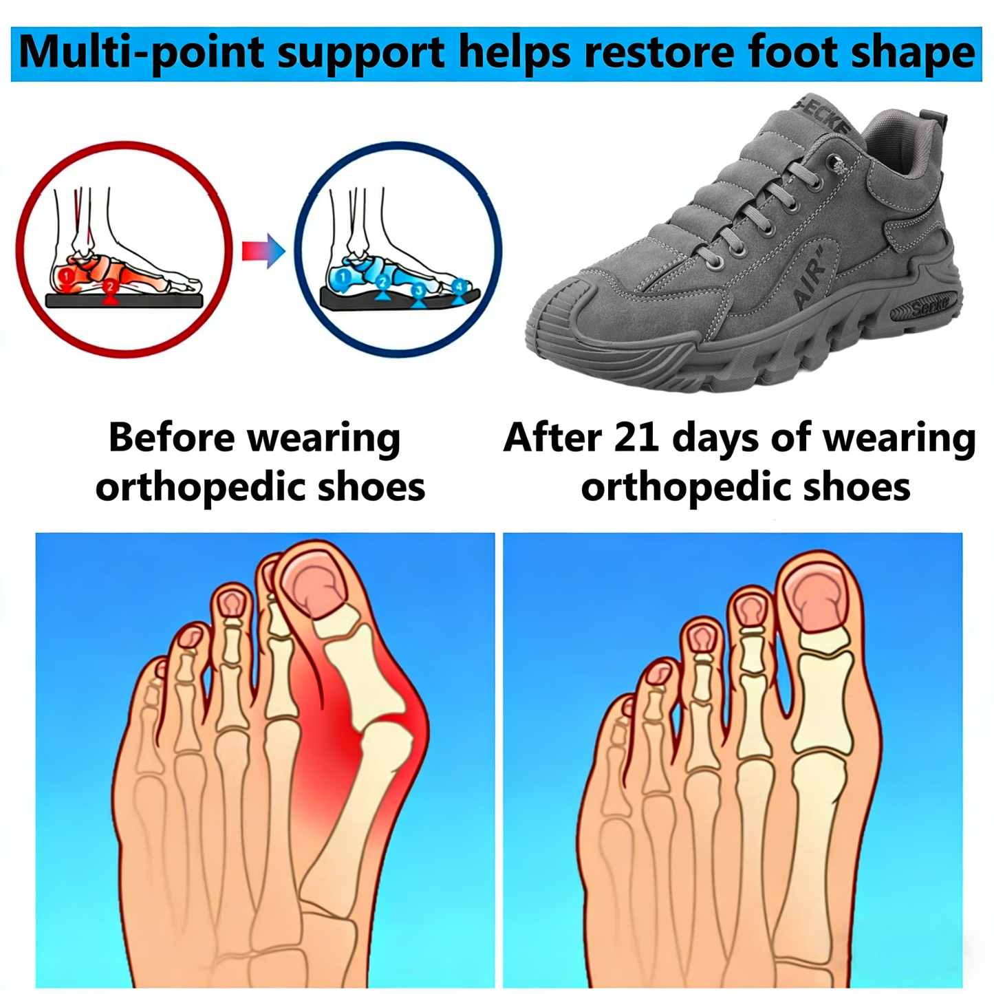 【⏰Limited Time 50% Off - Don't Miss It】Ergonomic Orthopedic Shoes - ✅️ Posture Correction While Walking - Waterproof and Anti-Slip 👞 Selected Australian Leather