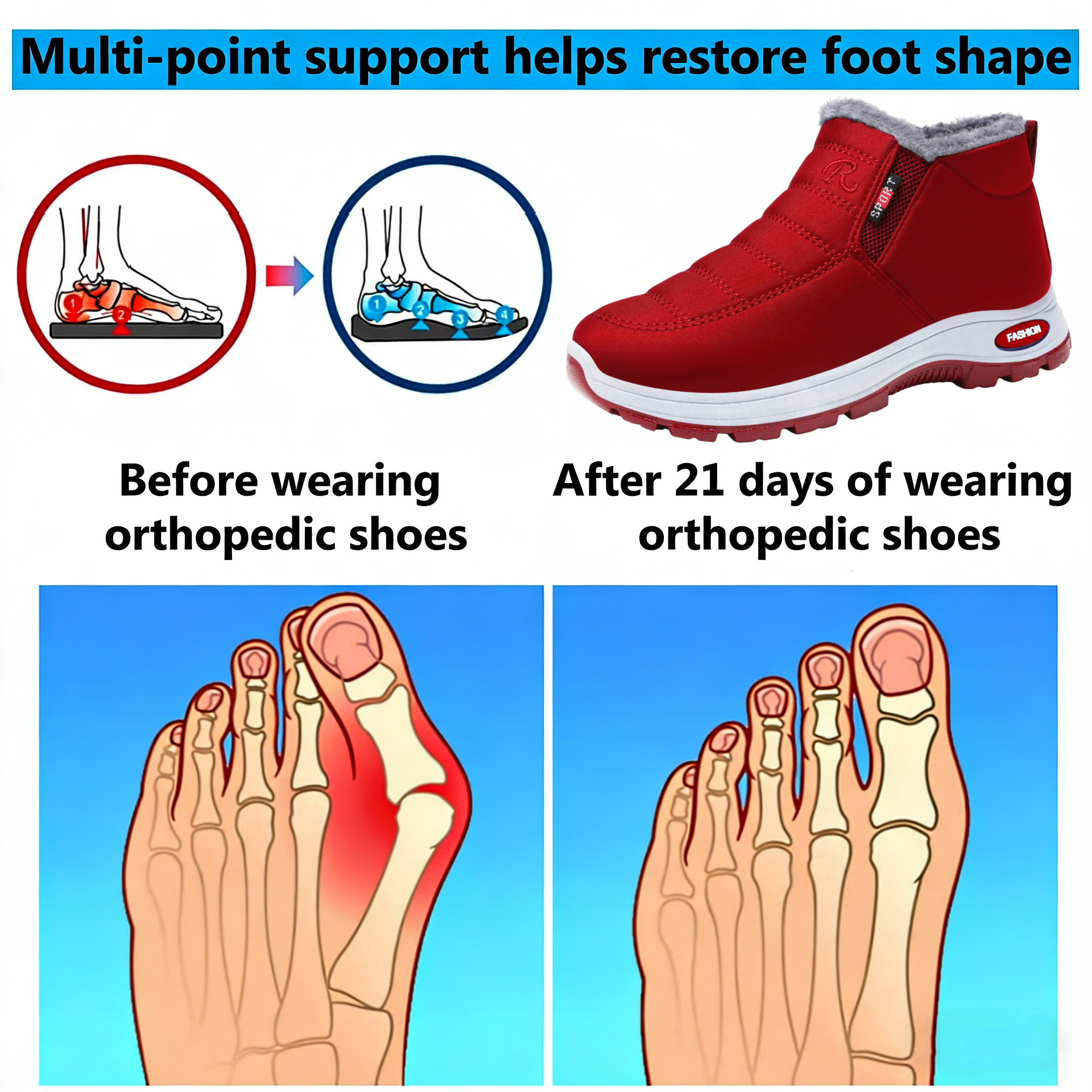 【⏰Limited Time 50% Off - Don't Miss It】Latest Ergonomic Wool Shoes - ✅️Corrects Posture While Walking - Improved Design, Warm, Waterproof and Anti-Slip 👞