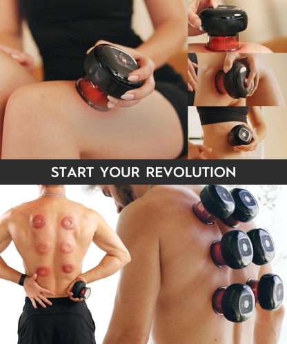 Original 4-in-1 Smart Cupping Massager