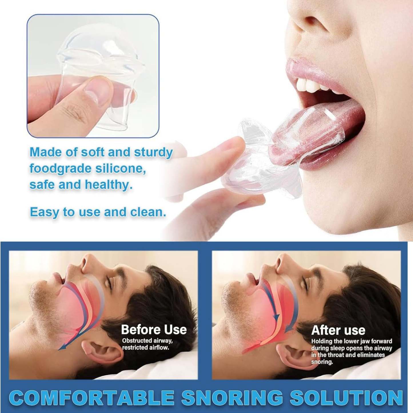 Tongue Stabilizer Mouthguard – Reusable, BPA-Free Anti-Snoring Solution for Better Sleep, Comfortable Tongue Fixator for Men and Women