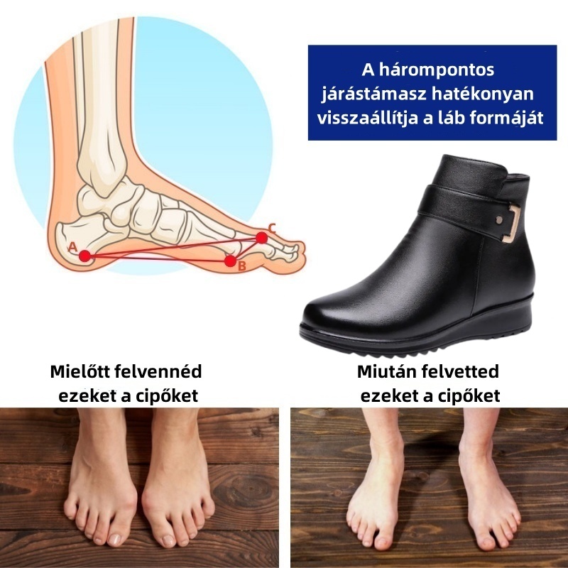 Baralen® - Ergonomikus, vízálló, fájdalomcsillapító bőr ortopéd cipők - Új téli kollekció