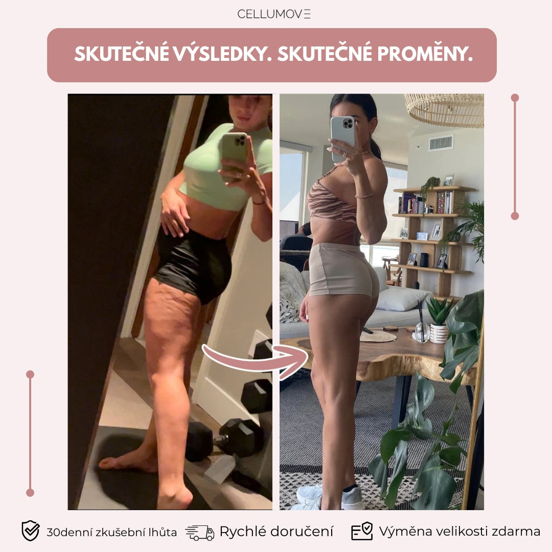 Anticelulitidní legíny pro ženy, které už vyzkoušely všechno – viditelné výsledky za 14 dní