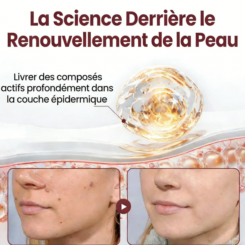 Tag Recede™ Traitement Verrues et Papillomes au Venin d’Abeille + Acide Salicylique
