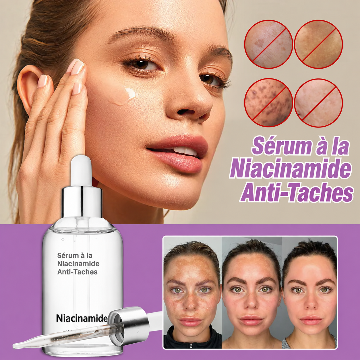 ✨ Sérum Correcteur de Taches à la Niacinamide 10 % – Teint Plus Uniforme