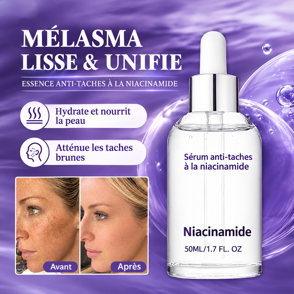 ✨ Sérum Correcteur de Taches à la Niacinamide 10 % – Teint Plus Uniforme