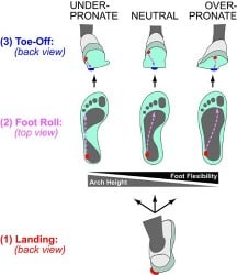 Iperpronazione nei bambini piccoli: i primi segnali Primi segni di iperpronazione nei bambini piccoli