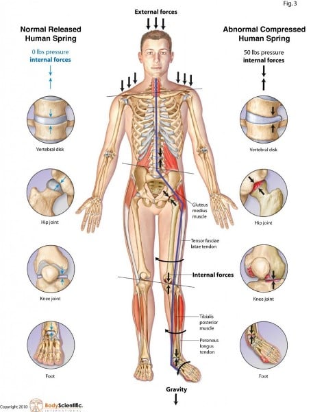 Nessuna scarpa di supporto deforma la postura e il corpo