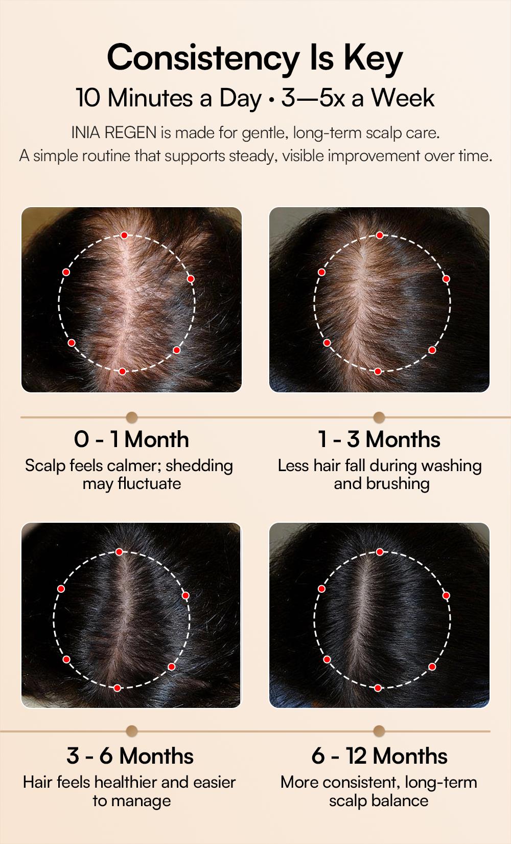 INIA REGEN Laser Hair Growth Cap, Help Reduce Shedding & Support Thicker Hair | 398 Lasers & LEDs Full-Scalp Red Light Therapy, Blue Light Scalp Care, Wireless & Portable,Summer Beauty Gift Ideas INIA REGEN Laser Hair Growth Cap, Help Reduce Shedding & Support Thicker Hair | 398 Lasers & LEDs Full-Scalp Red Light Therapy, Blue Light Scalp Care, Wireless & Portable,Summer Beauty Gift Ideas