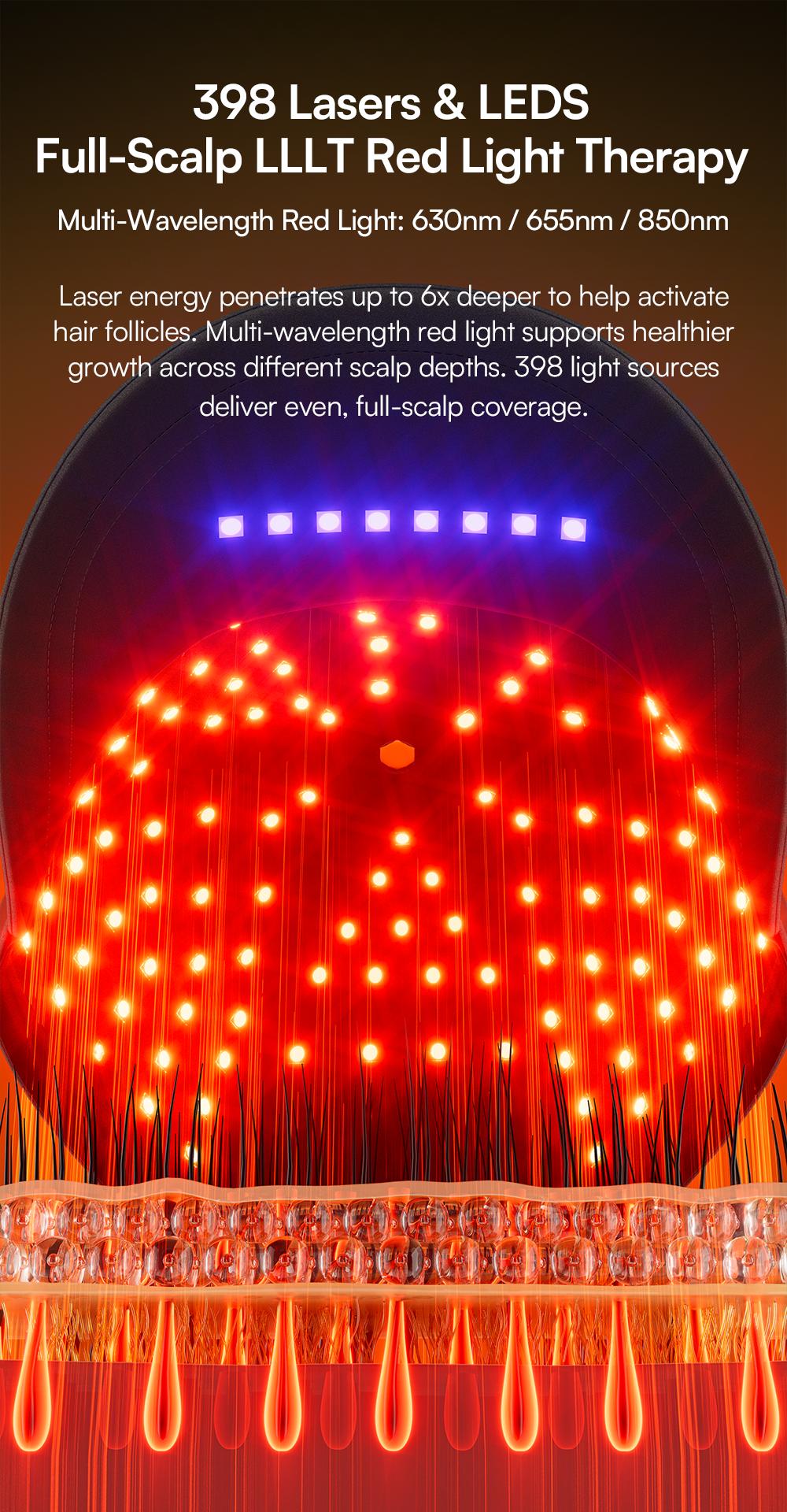 INIA REGEN Laser Hair Growth Cap, Help Reduce Shedding & Support Thicker Hair | 398 Lasers & LEDs Full-Scalp Red Light Therapy, Blue Light Scalp Care, Wireless & Portable,Summer Beauty Gift Ideas INIA REGEN Laser Hair Growth Cap, Help Reduce Shedding & Support Thicker Hair | 398 Lasers & LEDs Full-Scalp Red Light Therapy, Blue Light Scalp Care, Wireless & Portable,Summer Beauty Gift Ideas
