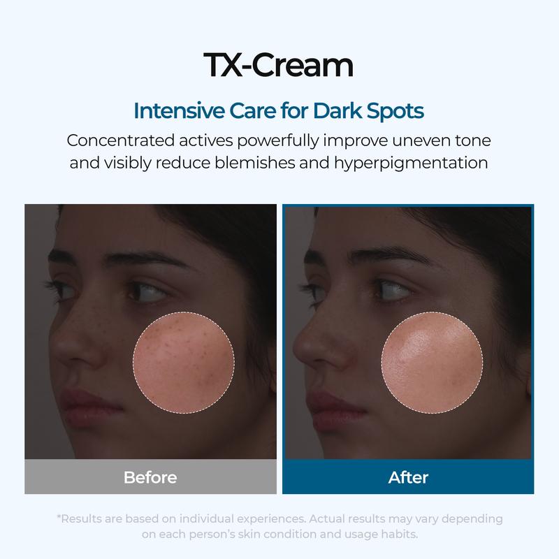 TX Cream 50ml, Nano-sized Tranexaminc Acid For Dark Spots & Hyperpigmentation