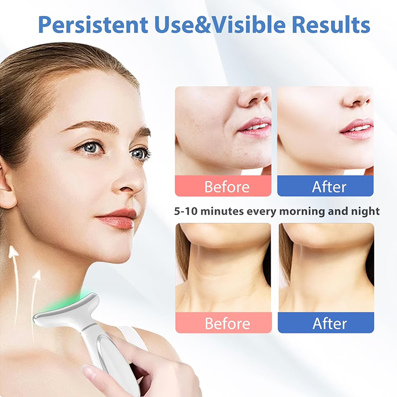 LED Facial Sculptor-7 Color Portable Facial Massager