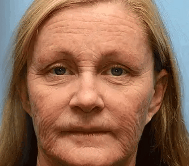 𝑶𝒇𝒇𝒊𝒄𝒊𝒂𝒍 𝑺𝒕𝒐𝒓𝒆👍| Regain youthful skin nown 💫STDEI® BOTOX & VITA A RETINOL SHOT Wrinkle Lift Tightening Cream