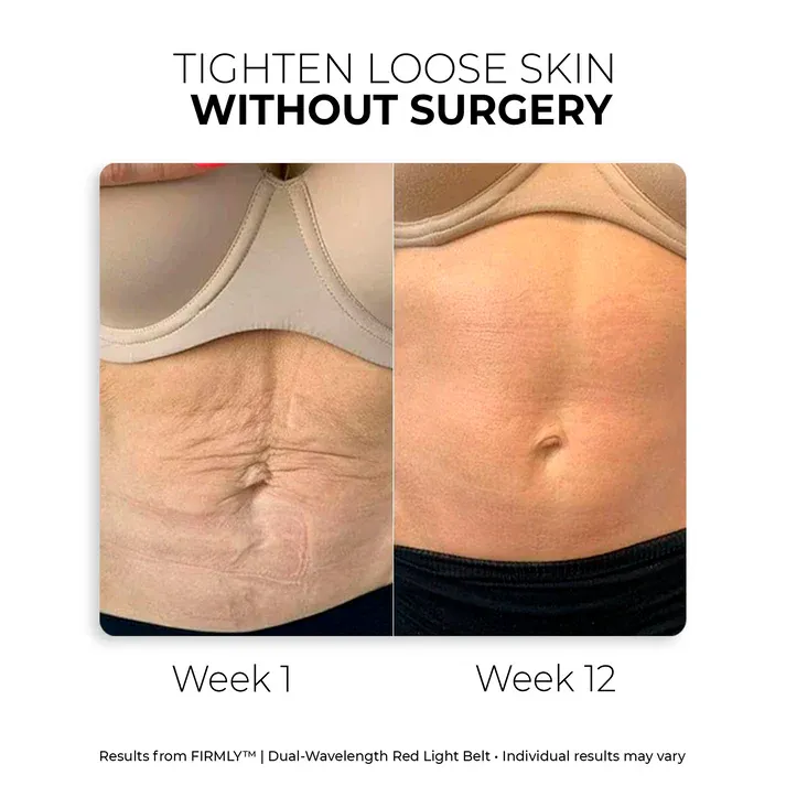 Nutrofuels™ Red Light Belt for Loose Postpartum Belly Skin & Stretch Marks