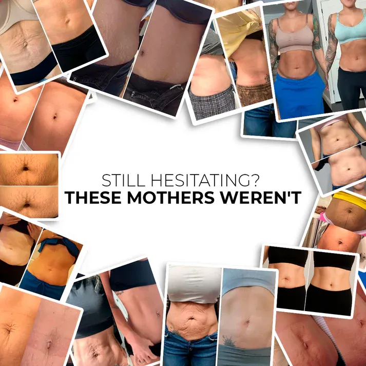 Nutrofuels™ Red Light Belt for Loose Postpartum Belly Skin & Stretch Marks