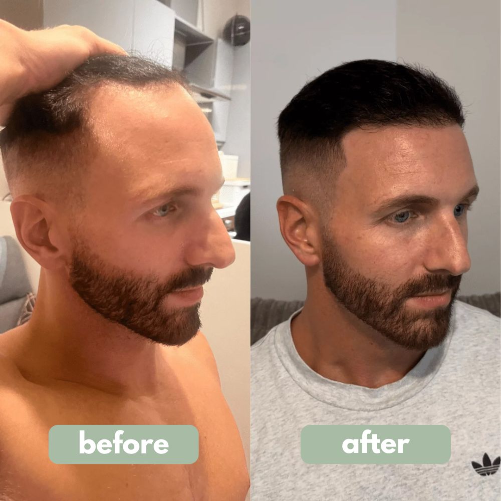 Unrosebody - Hair Growth Serum
