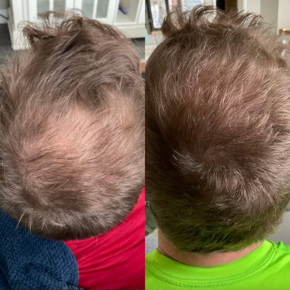 Unrosebody - Hair Growth Serum