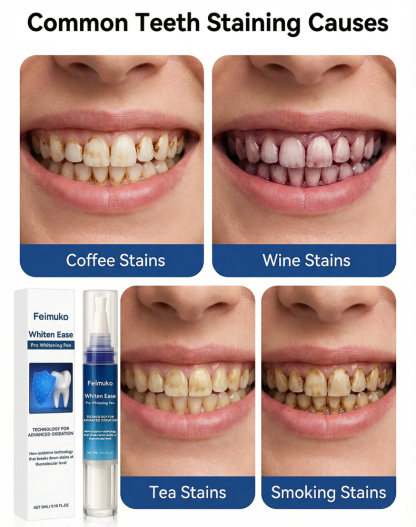 [10-Minute Quick Whitening] Dentist-Recommended Teeth Whitening Pen