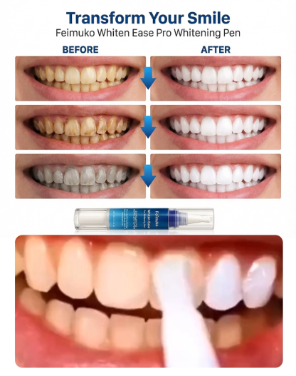 [10-Minute Quick Whitening] Dentist-Recommended Teeth Whitening Pen