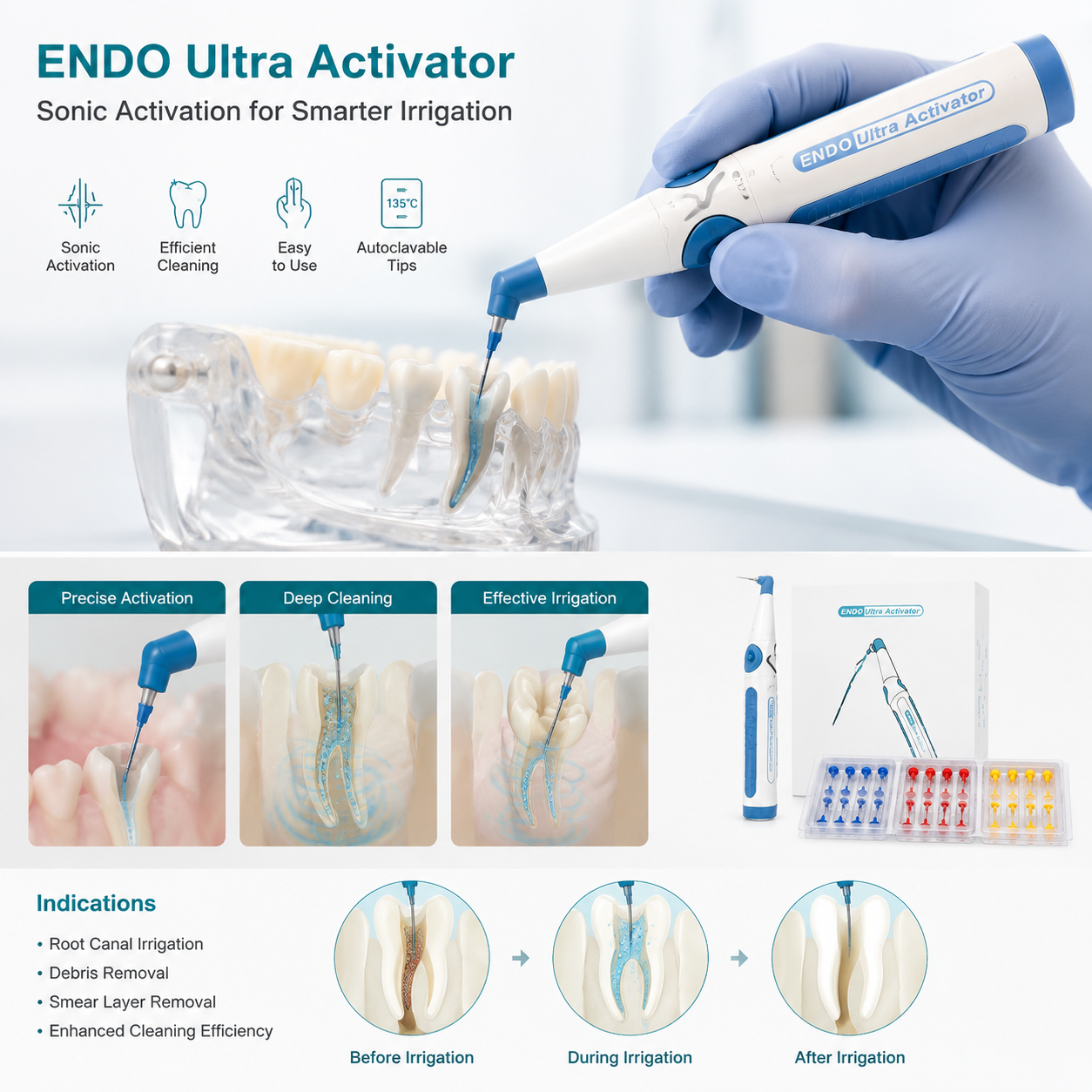 Dental Endodontics Ultra Activator Handpiece | Root Canal Irrigation Sonic Activator Kit with 60Pcs Tips