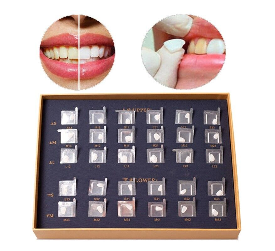 Dental Composite Porcelain Veneers Teeth Whitening Resin Crown Veneer