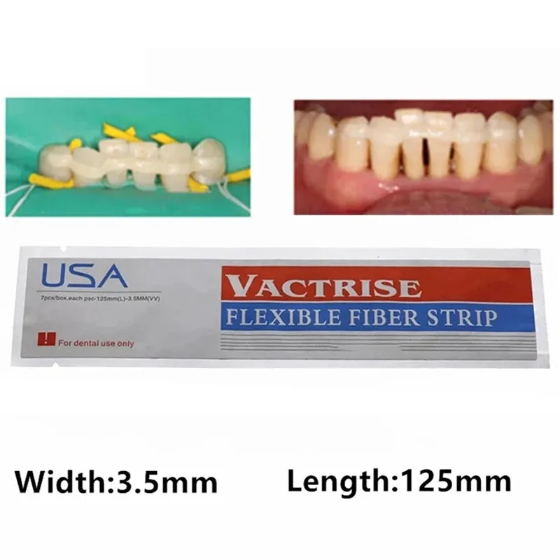 Dental Flexible Fiber Strip Dental Glass Splint Loose Tooth Light Cure Bonding