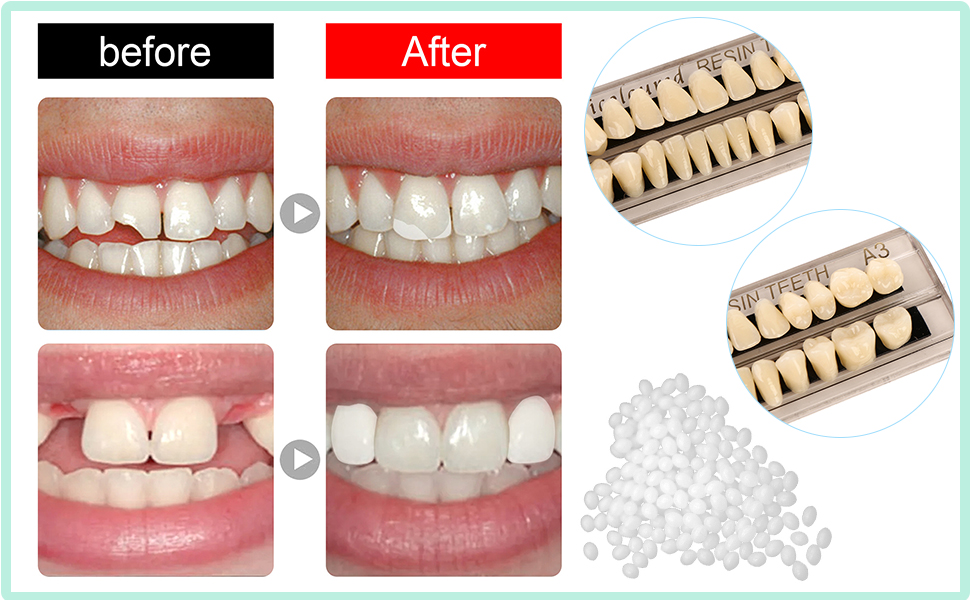 Dental Synthetic Acrylic Resin Tooth Denture False Teeth Upper Lower A2 A3 Color
