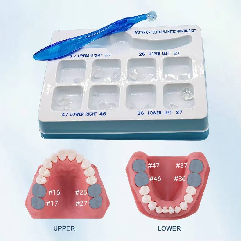 Dental Veneer Mould Kit Composite Resin Mold Light Cure Anterior Posterior Teeth