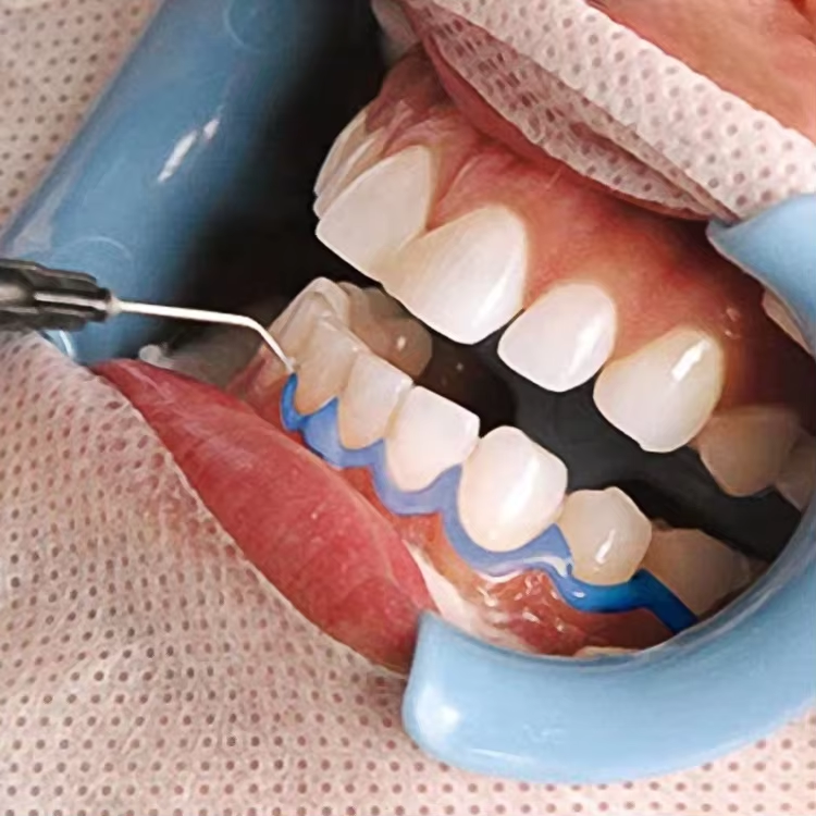 10Pcs Dental Teeth Whitening Gingival Gum Protector Liquid Dam Barrier 1.5/3ml Syringe