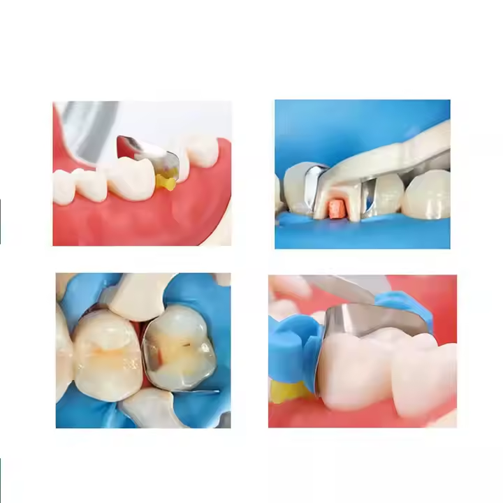 50x Dental Matrix Bands Ring Sectional Matrice Clamp Fit Palodent V3 Metal Band