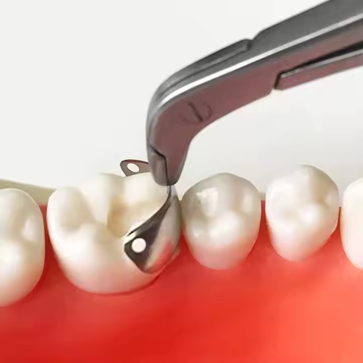 50x Dental Matrix Bands Ring Sectional Matrice Clamp Fit Palodent V3 Metal Band