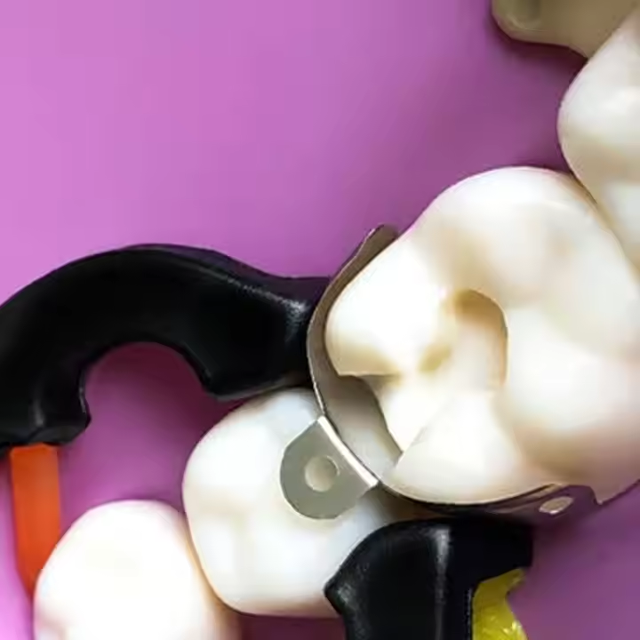 50x Dental Matrix Bands Ring Sectional Matrice Clamp Fit Palodent V3 Metal Band