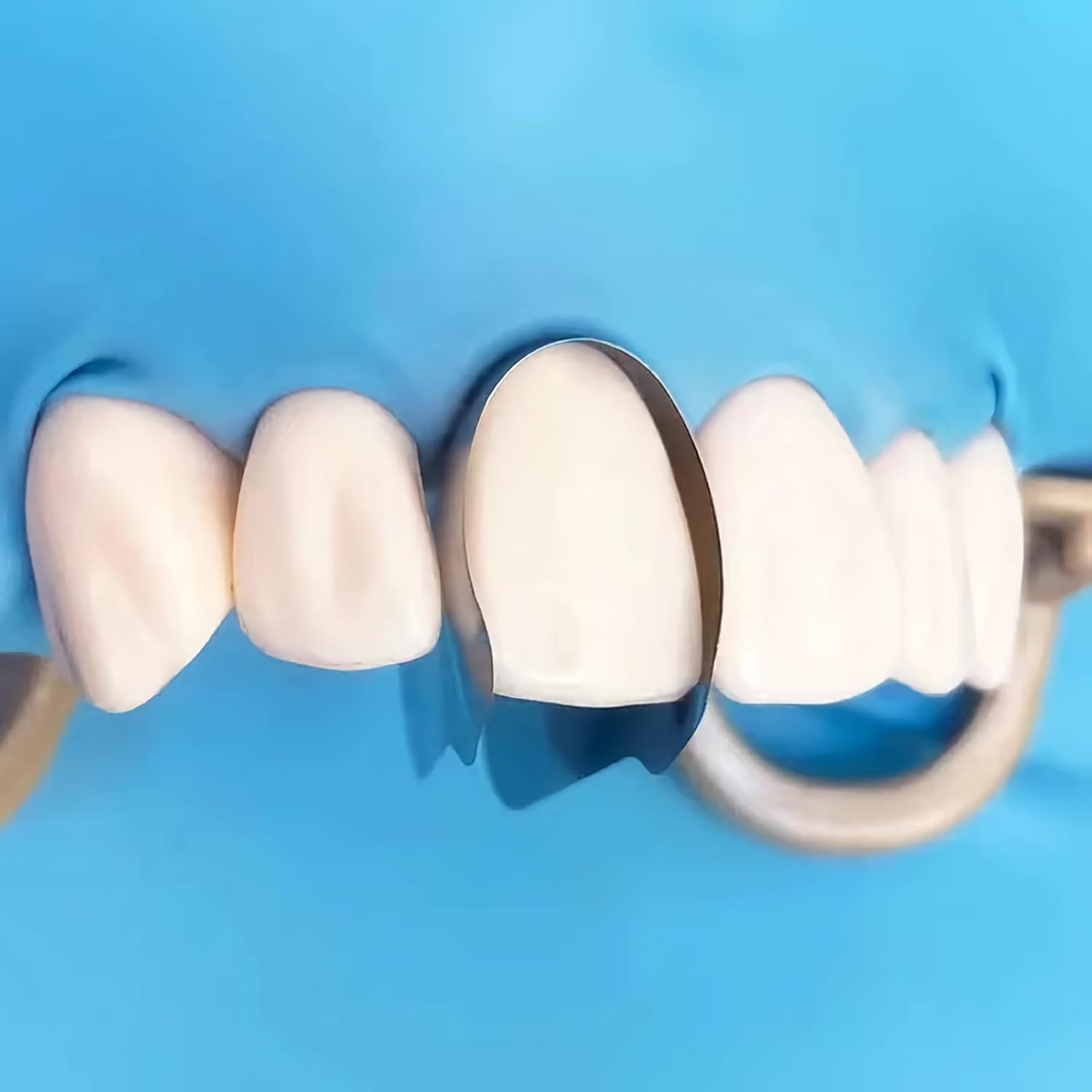 30pcs Dental Contoured Anterior Matrix Sectional System Metal Matrices Bands