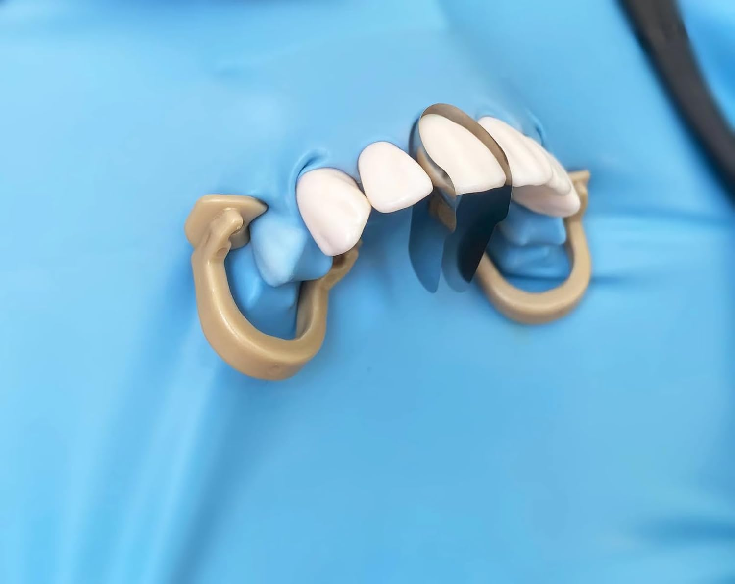 30pcs Dental Contoured Anterior Matrix Sectional System Metal Matrices Bands