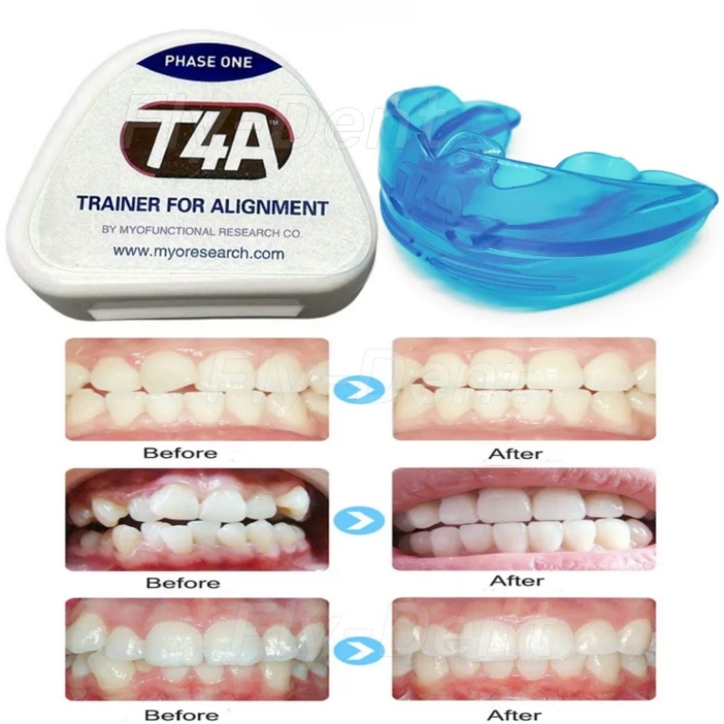 10Pcs Dental Orthodontic Teeth Trainer Braces Appliance | T4A T4B T4K Alignment For Kids & Adults Care