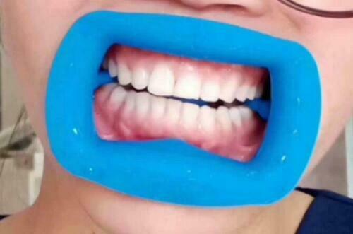 Dental Cheek Retractor 10Pcs, Soft Silicone Mouth Opener & Lip Expanders for Teeth Whitening, Blue Medical