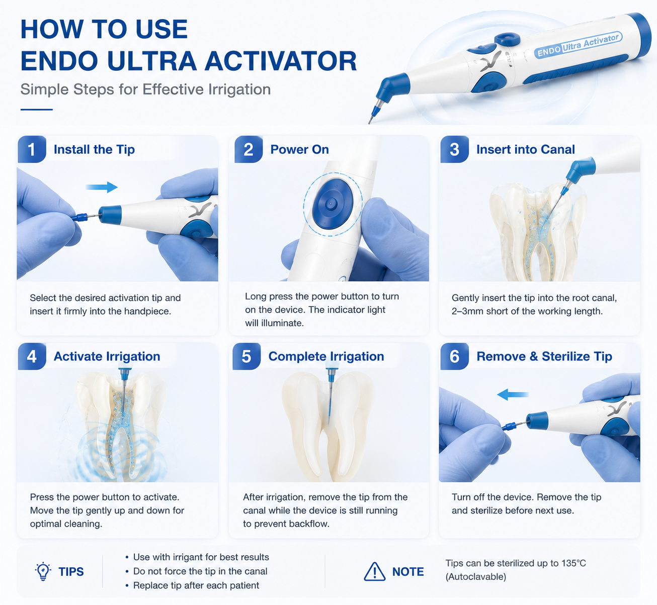 Dental Endodontics Ultra Activator Handpiece | Root Canal Irrigation Sonic Activator Kit with 60Pcs Tips