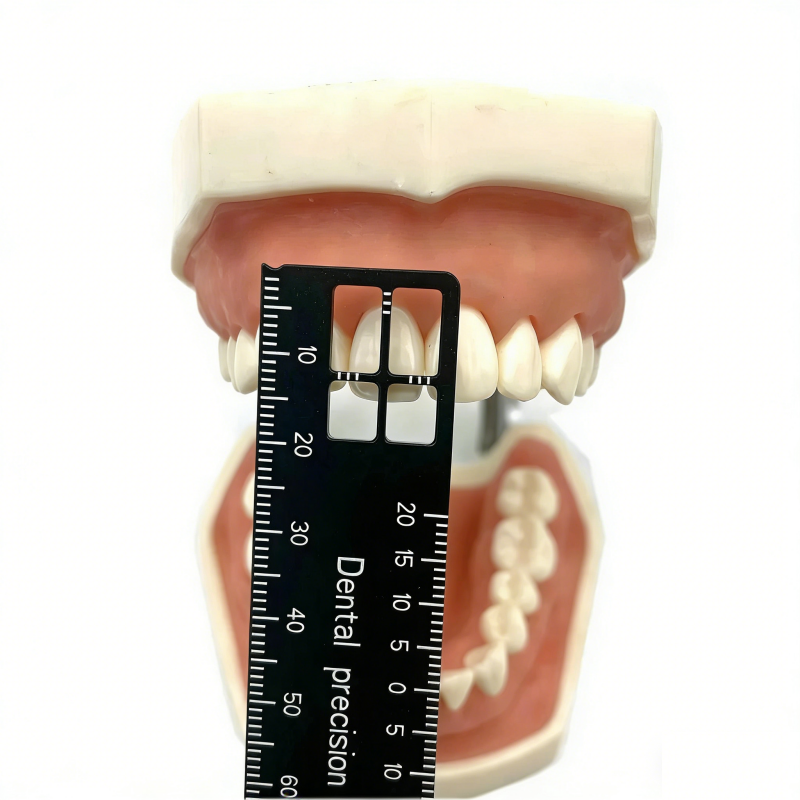 Dental Endodontic Measuring Ruler, Aluminum Finger Gauge Ring for Root Canal Files Reamers & Gutta Percha Pins