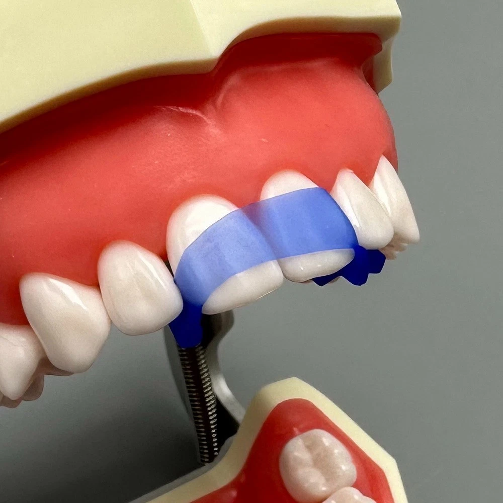 10Pcs Dental Elastic Wedges Protector All-in-one Front Anterior Teeth Matrices Wedge