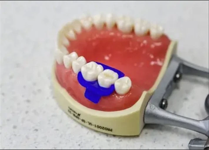 Silicone Dental Mini Rubber Dam Wedge  Isolation Suitable for Adults and Children 5pcs