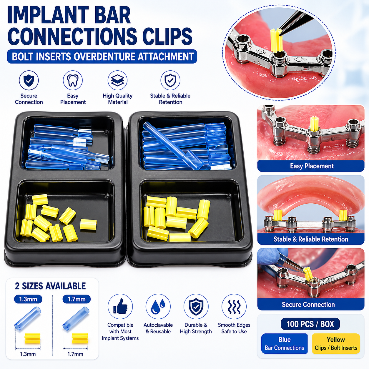 Dental Parts Implant Bar Connections Clips Bolt Inserts Overdenture Attachment 1.3mm 1.7mm