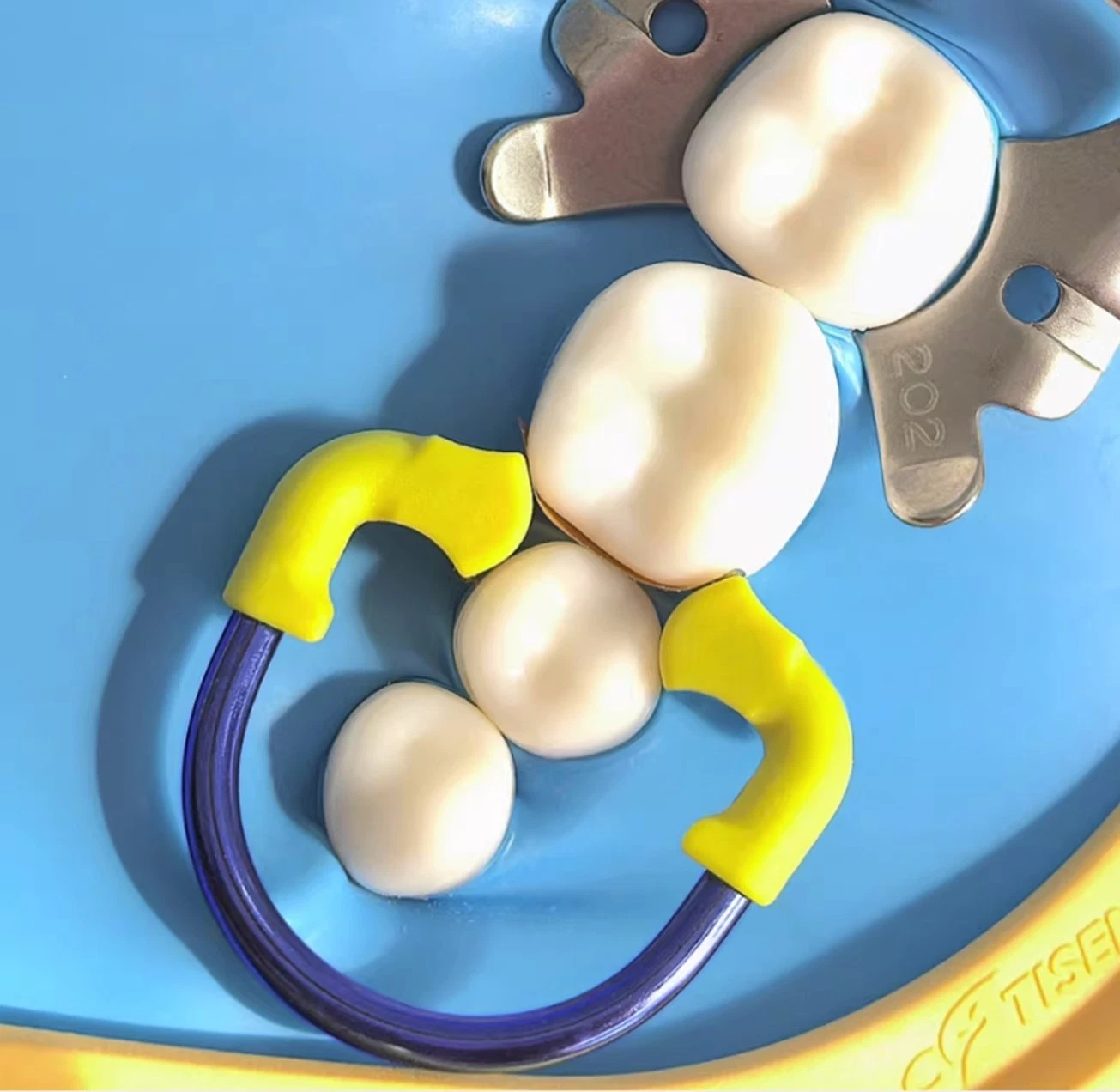 Dental Clamp Sectional Matrix Nickel Titanium Clamping Ring For Adults Kids