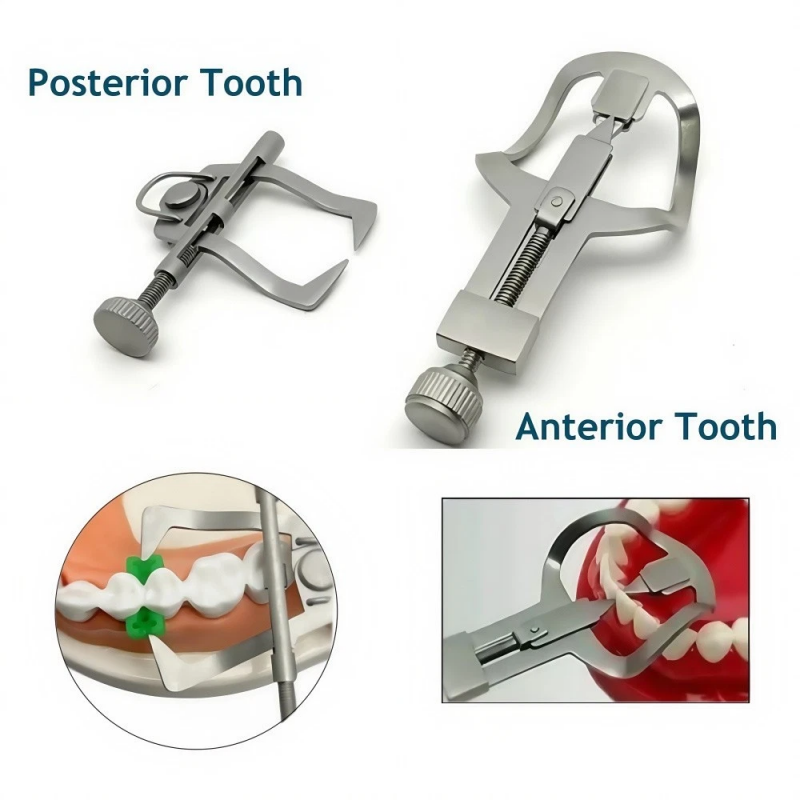 Dental Tooth Separator Divider Wedges Retainer for Anterior & Posterior, Orthodontic Restorative Matrix Tools