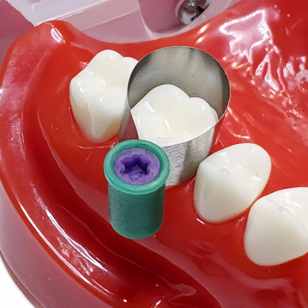 50Pcs Adapt SuperCap Dental Reel Matrix Bands Matrices Thickness 0.03/0.038mm