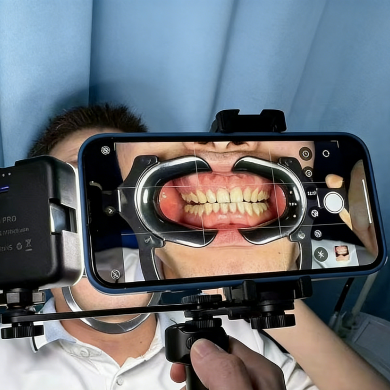 Portable Dental Photography Filling Light Mobile Phones Oral Light 64 LED Beads