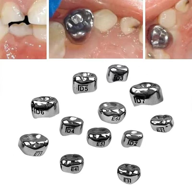 5Pcs Dental D Primary E Molar Kids Crowns Stainless Steel Primary Crown Pediatric
